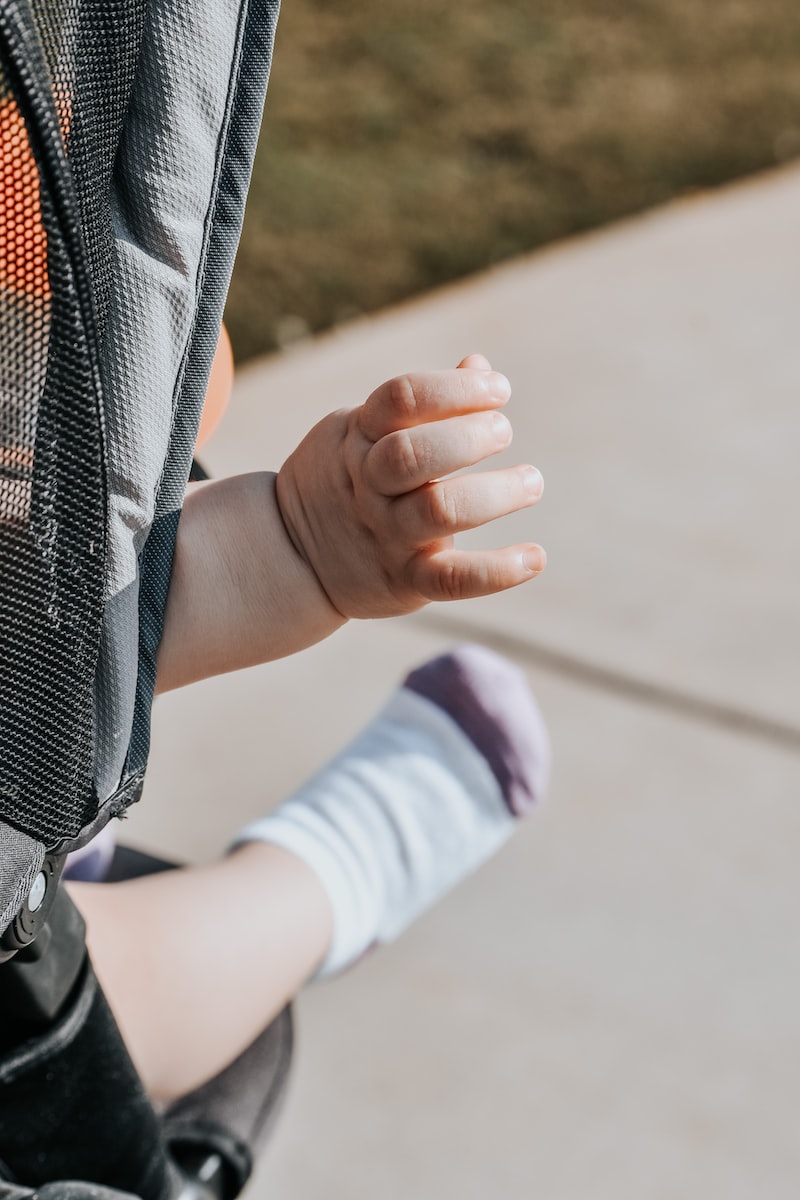 a child's arm with a cast on it